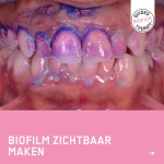foto-tijdens