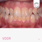 foto-voor-1